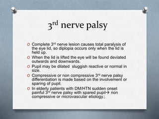 Diplopia by yugandhar tummala | PPTX