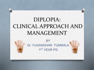 DIPLOPIA:
CLINICAL APPROACH AND
MANAGEMENT
BY
Dr. YUGANDHAR. TUMMALA
1ST YEAR PG
 