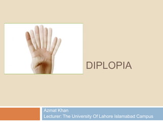 DIPLOPIA
Azmat Khan
Lecturer: The University Of Lahore Islamabad Campus
 