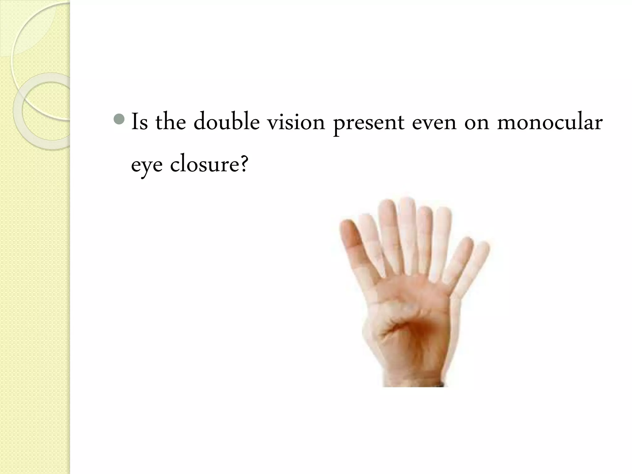 Diplopia charting | PPTX