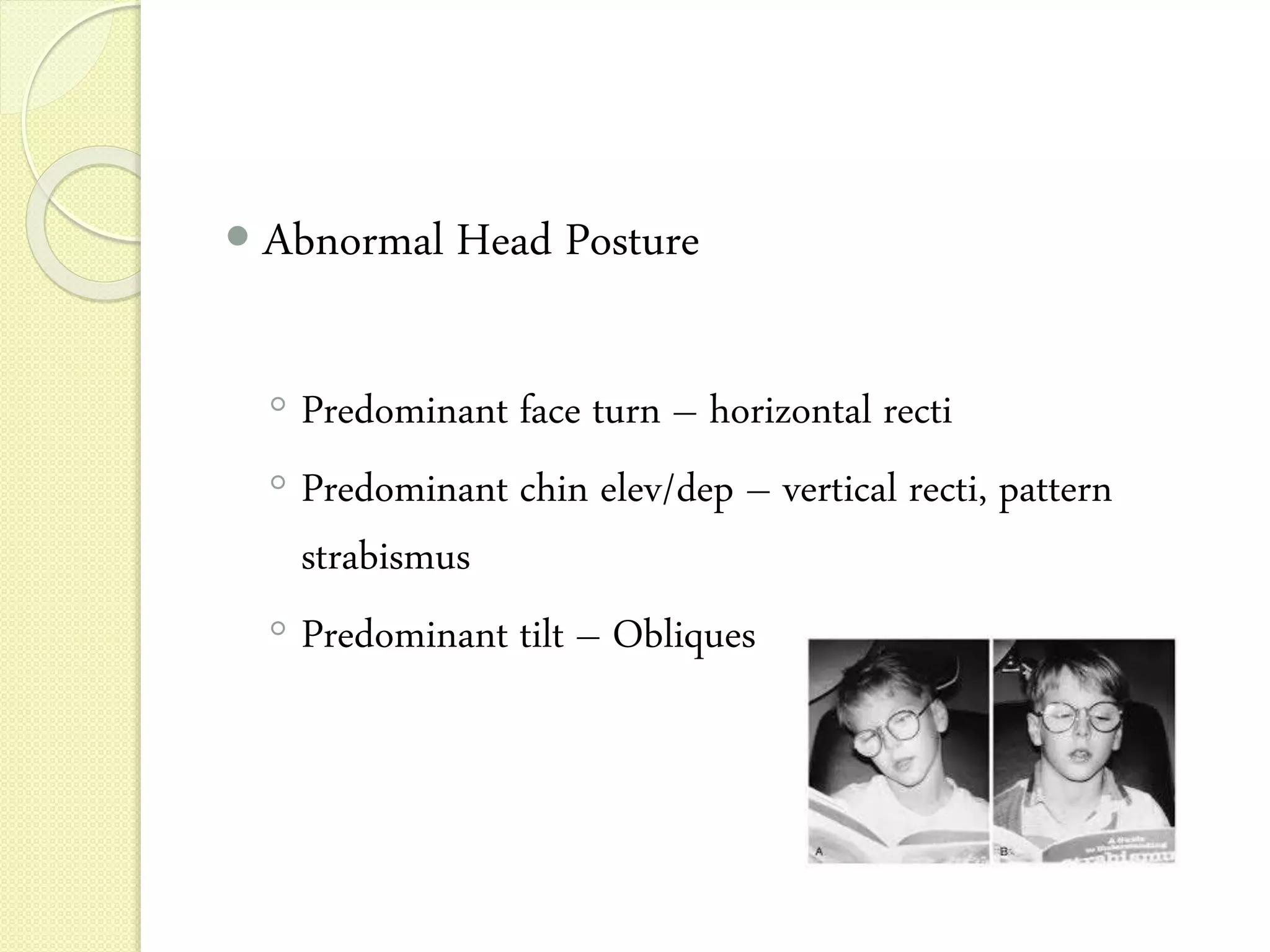 Diplopia Charting Examples Diplopia charting | PPTX