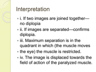 Diplopia charting | PPTX