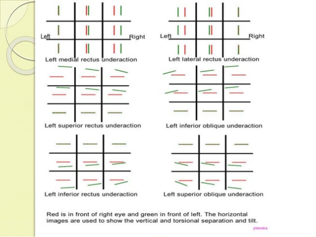 Double Vision Test Chart