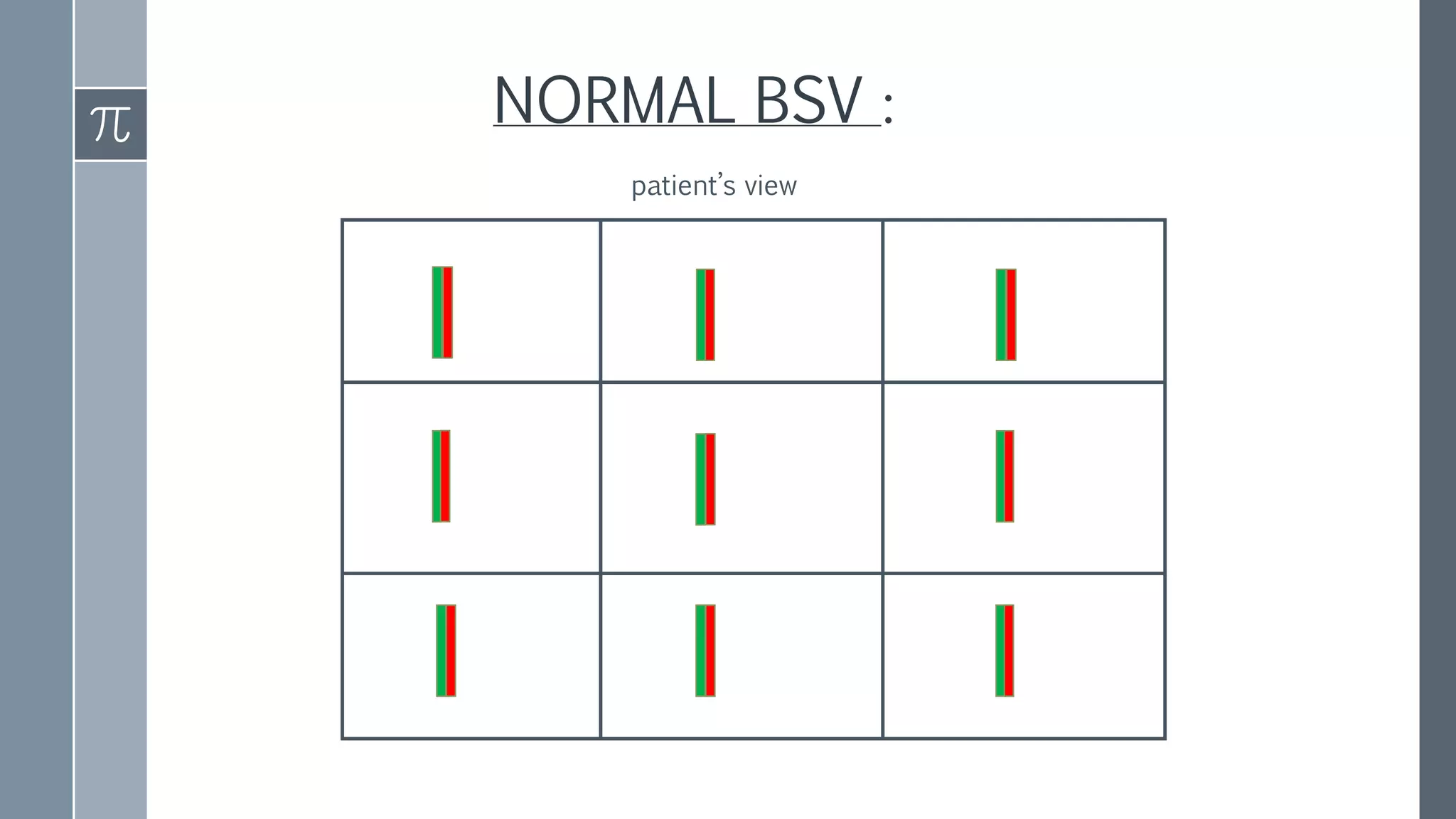 Diplopia Chart Normal Diplopia charting | PPTX