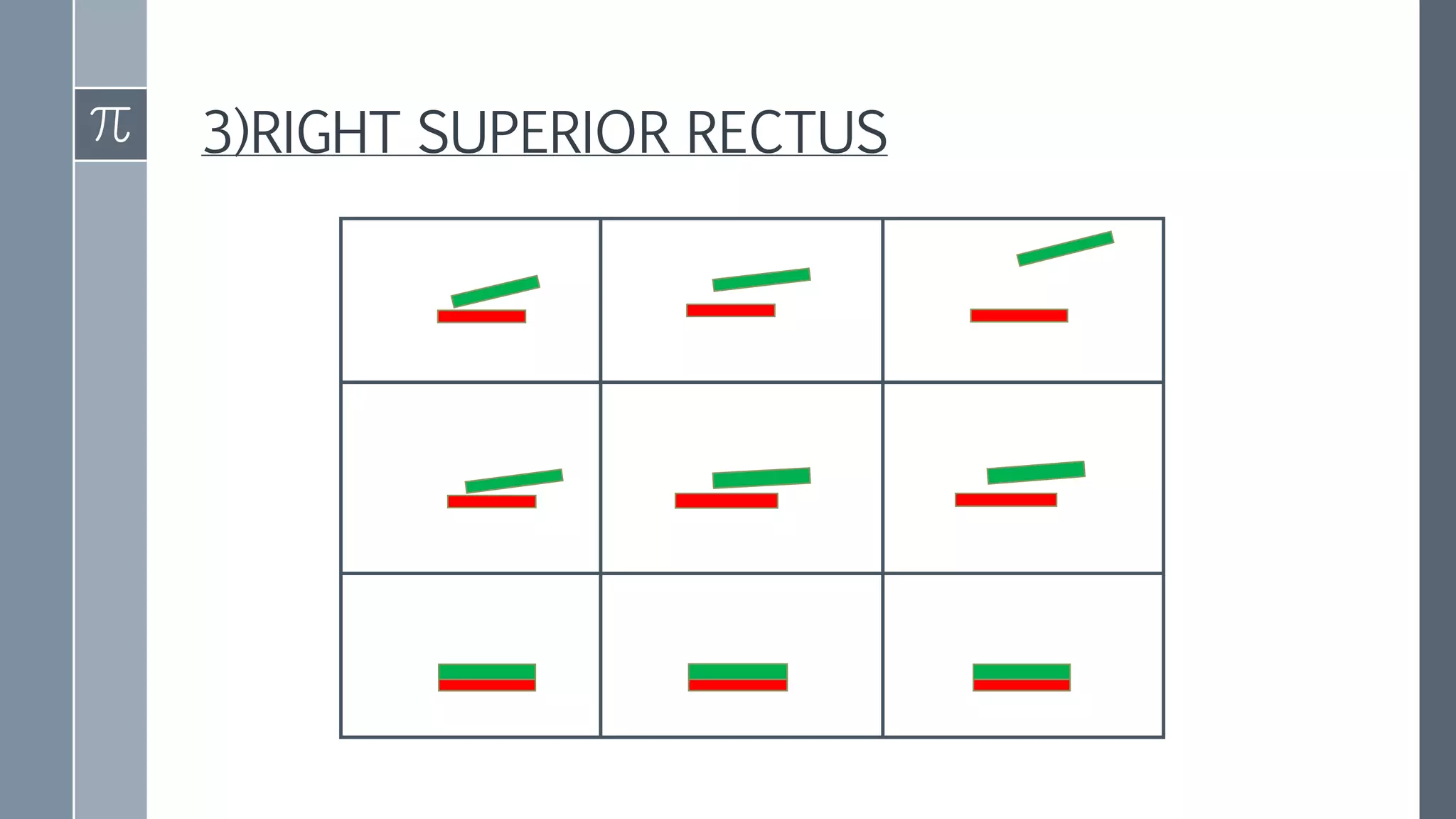 Diplopia Charting Examples Diplopia charting | PPTX