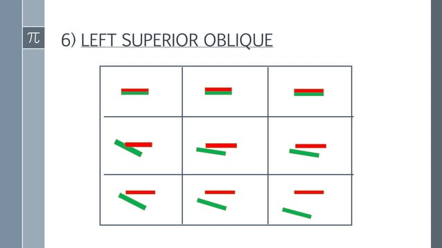 Diplopia Charting Examples Diplopia charting | PPTX | Eye and Vision Conditions | Diseases and ...