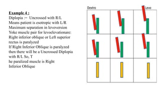 Diplopia Charting Examples Diplopia charting in Ocular Motility pptx... | PPTX