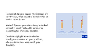 Diplopia charting in Ocular Motility pptx... | PPTX