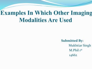 Examples In Which Other Imaging
Modalities Are Used
Submitted By:
Mukhtiar Singh
M.Phil 1st
14662
 