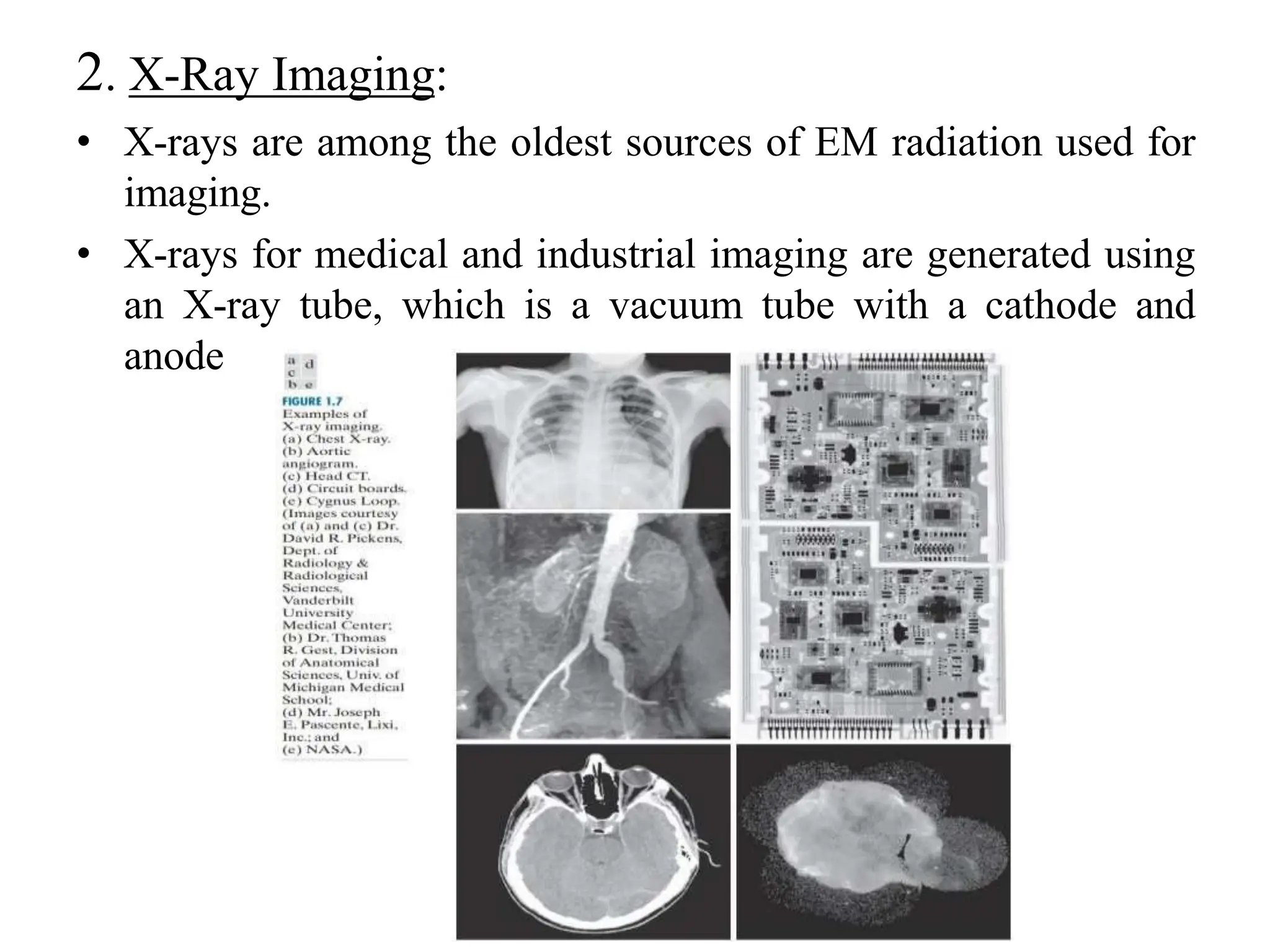2. X-Ray Imaging:
• X-rays are among the oldest sources of EM radiation used for
imaging.
• X-rays for medical and industrial imaging are generated using
an X-ray tube, which is a vacuum tube with a cathode and
anode
 