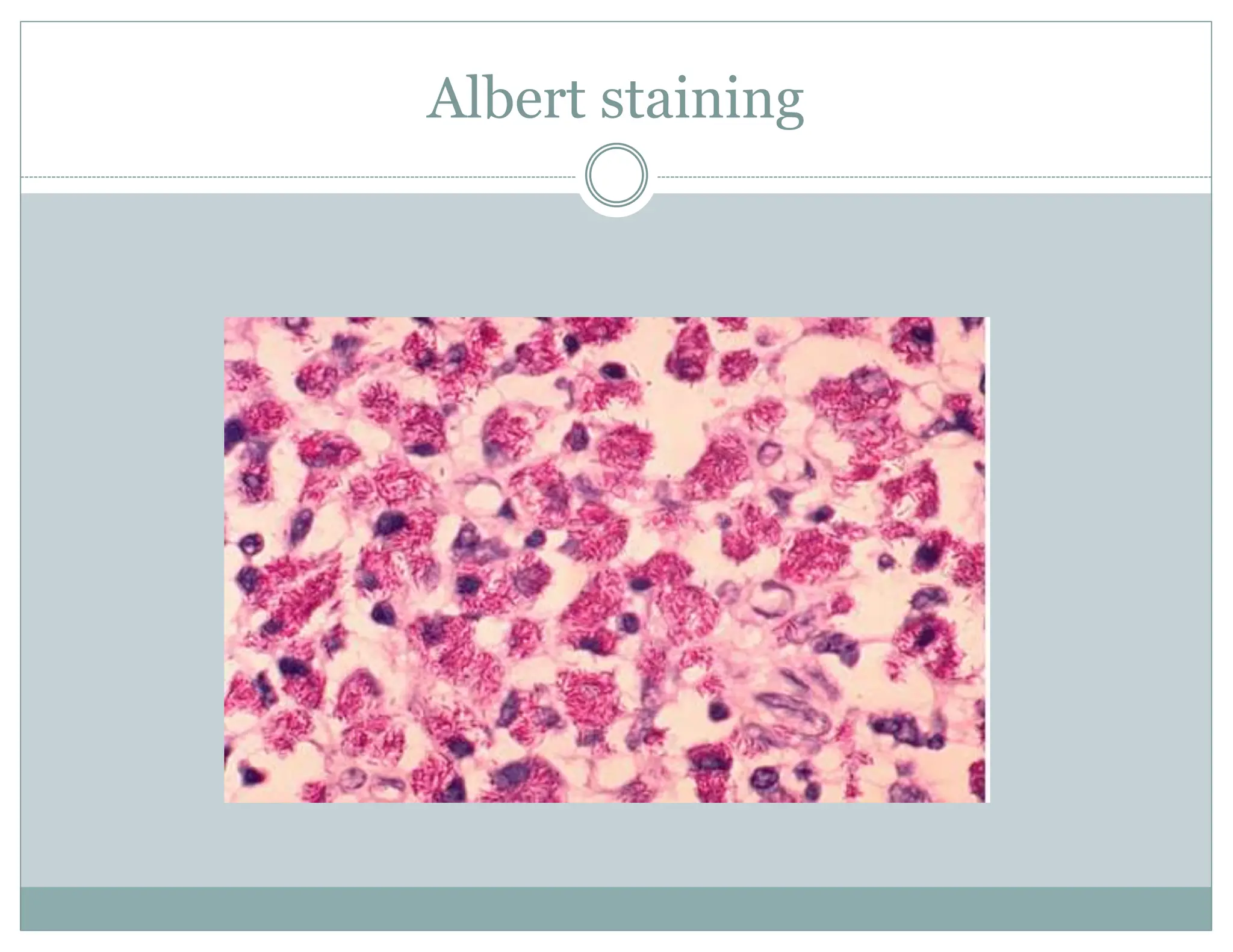 Albert staining
 