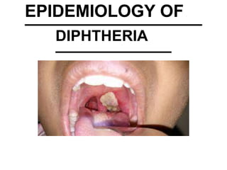 EPIDEMIOLOGY OF
DIPHTHERIA
 