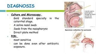 DIAGNOSIS
3. Culture and Microscopy:
 Gold standard specially in the
catarrhal stage.
 A saline nasal swab
 Swab from the nasopharynx
 Direct plate method
4. PCR:
 most sensitive
 can be done even after antibiotic
exposure.
 
