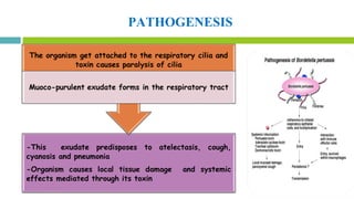 PATHOGENESIS
 