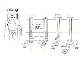 Jetting
 