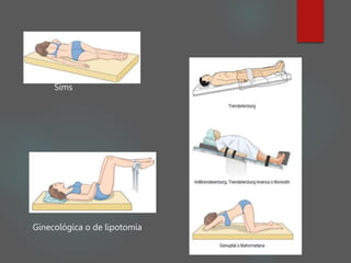 Sims
Ginecológica o de lipotomía
 