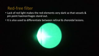 Red-free filter
• Lack of red light makes the red elements very dark so that vessels &
pin point haemorrhages stand out.
• It is also used to differentiate between retinal & choroidal lesions.
 