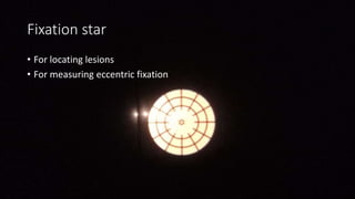 Fixation star
• For locating lesions
• For measuring eccentric fixation
 