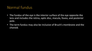 Normal fundus
• The fundus of the eye is the interior surface of the eye opposite the
lens and includes the retina, optic disc, macula, fovea, and posterior
pole.
• The term fundus may also be inclusive of Bruch's membrane and the
choroid.
 