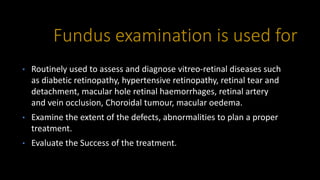 Fundus examination is used for
• Routinely used to assess and diagnose vitreo-retinal diseases such
as diabetic retinopathy, hypertensive retinopathy, retinal tear and
detachment, macular hole retinal haemorrhages, retinal artery
and vein occlusion, Choroidal tumour, macular oedema.
• Examine the extent of the defects, abnormalities to plan a proper
treatment.
• Evaluate the Success of the treatment.
 