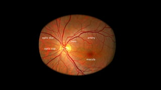 optic disc artery
vein
optic cup
macula
 