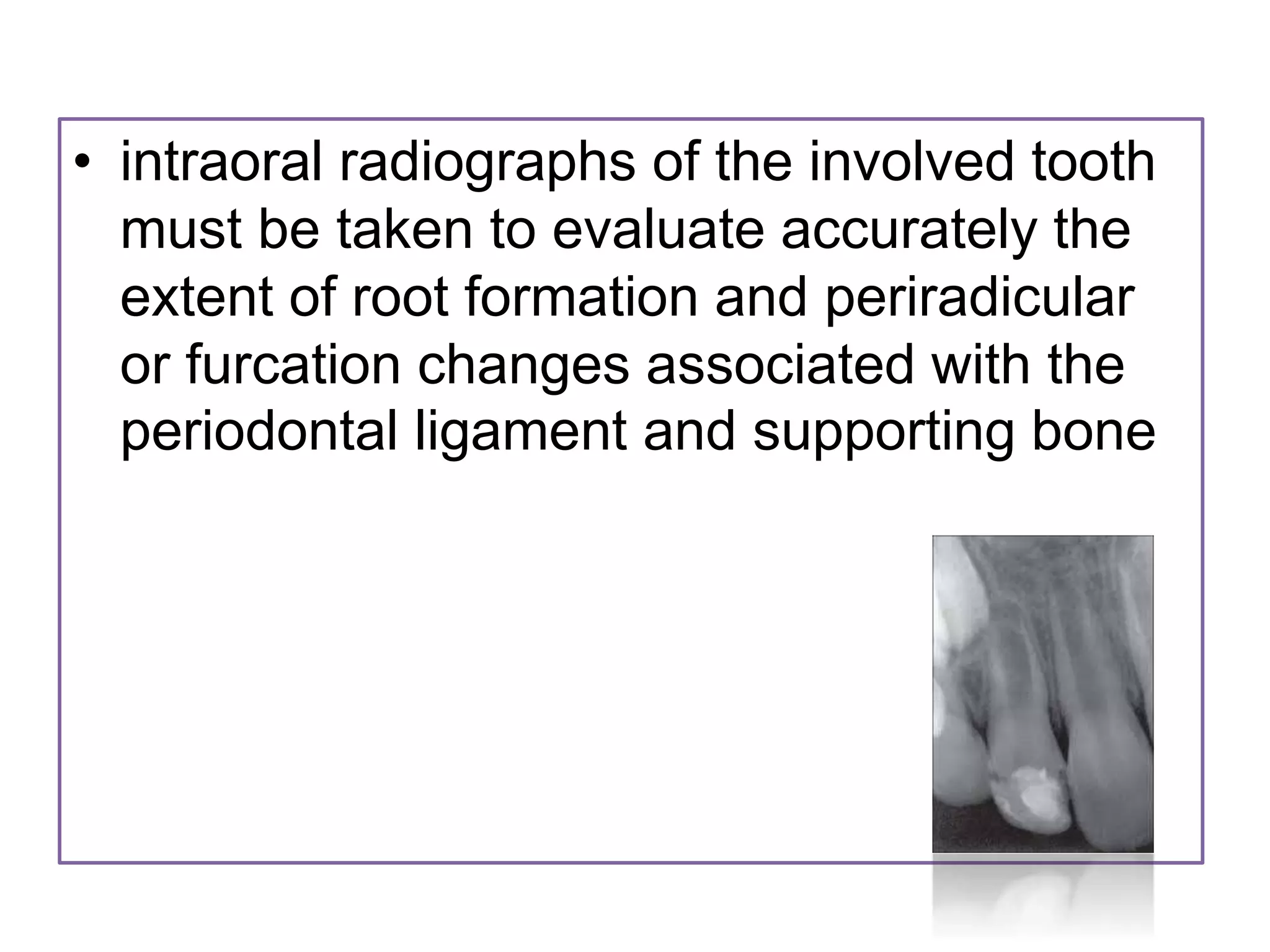 • intraoral radiographs of the involved tooth
must be taken to evaluate accurately the
extent of root formation and periradicular
or furcation changes associated with the
periodontal ligament and supporting bone
 