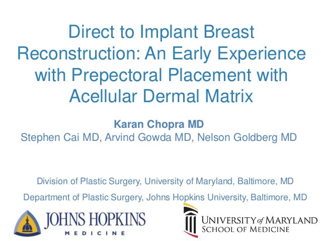 Direct to Implant Prepectoral Breast Reconstruction