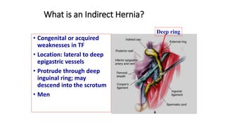 What is an Indirect Hernia?
• Congenital or acquired
weaknesses in TF
• Location: lateral to deep
epigastric vessels
• Protrude through deep
inguinal ring; may
descend into the scrotum
• Men
Deep ring
 