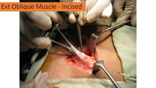 Ext Oblique Muscle - Incised
 