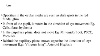 Uses
• Opacities in the ocular media are seen as dark spots in the red
fundal glow
• In front of the pupil, it moves in the direction of eye movement Eg.
Cells, flare, hyphema
• In the pupillary plane, does not move Eg. Mitterndorf dot, PSCC,
Vacoules
• Behind the pupillary plane, moves opposite the direction of eye
movement E.g.: Vitreous hmg”, Asteroid Hyalosis
 