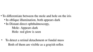 • To differentiate between the mole and hole on the iris
• In oblique illumination, both appears dark
• In Distant direct ophthalmoscopy,
Mole- Appears dark
Hole- red glow is seen
• To detect a retinal detachment or fundal mass
Both of them are visible as a grayish reflex
 