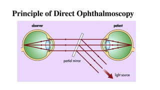 Principle of Direct Ophthalmoscopy
 