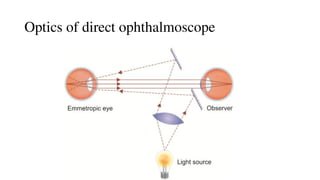 Optics of direct ophthalmoscope
 