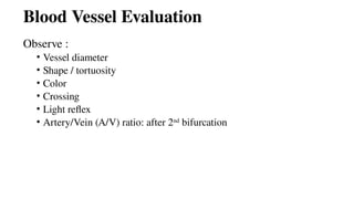 Blood Vessel Evaluation
Observe :
• Vessel diameter
• Shape / tortuosity
• Color
• Crossing
• Light reflex
• Artery/Vein (A/V) ratio: after 2nd
bifurcation
 