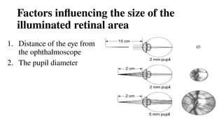 Factors influencing the size of the
illuminated retinal area
1. Distance of the eye from
the ophthalmoscope
2. The pupil diameter
 