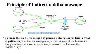 Principle of Indirect ophthalmoscope
• To make the eye highly myopic by placing a strong convex lens in front
of patient’s eye so that the emergent rays from an area of the fundus are
brought to focus as a real inverted image between the lens and the
observer’s eye
Binocular Indirect Ophthalmoscope(AAO)
 