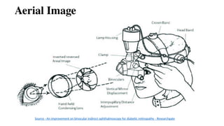 Aerial Image
Source - An improvement on binocular indirect ophthalmoscopy for diabetic retinopathy - Researchgate
 