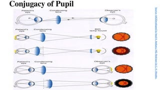 Conjugacy of Pupil
Source-
AAODeveloped
by
Neal
H.
Atebara,
MD.
Redrawn
by
C.
H.
Wooley.
 