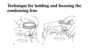 Technique for holding and focusing the
condensing lens
 