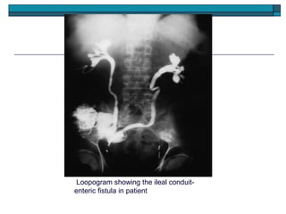 Loopogram Order Direct contrast investigations | PPT
