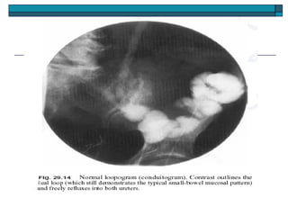 Direct Inject Contrast Direct contrast investigations | PPT