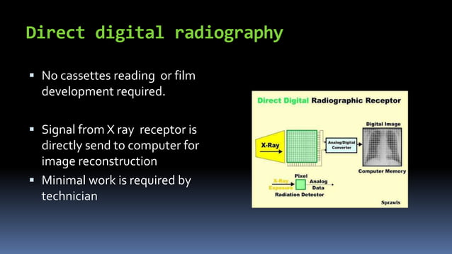How Does Radiography Work How Does Direct Digital Radiography Work – ORSJO
