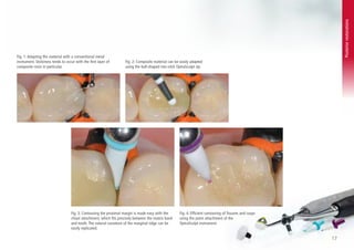 Fill Tips Direct_Fill-TipsTricks.pdf