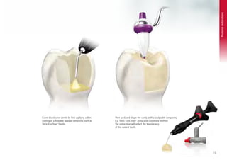 Fill Tips Direct_Fill-TipsTricks.pdf