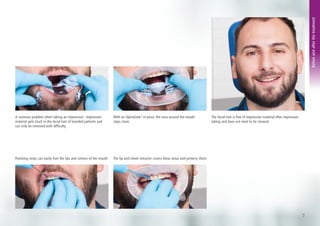 Fill Tips Direct_Fill-TipsTricks.pdf