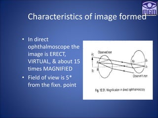 Characteristics of image formed
• In direct
ophthalmoscope the
image is ERECT,
VIRTUAL, & about 15
times MAGNIFIED
• Field of view is 5*
from the fixn. point
 