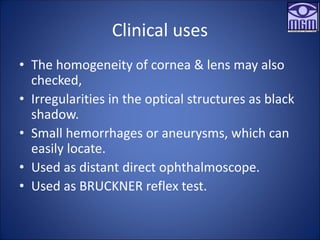 Clinical uses
• The homogeneity of cornea & lens may also
checked,
• Irregularities in the optical structures as black
shadow.
• Small hemorrhages or aneurysms, which can
easily locate.
• Used as distant direct ophthalmoscope.
• Used as BRUCKNER reflex test.
 