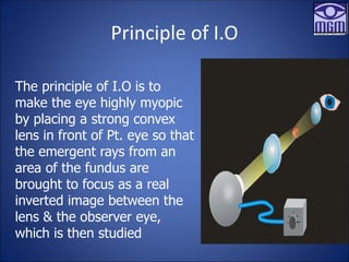 Principle of I.O
The principle of I.O is to
make the eye highly myopic
by placing a strong convex
lens in front of Pt. eye so that
the emergent rays from an
area of the fundus are
brought to focus as a real
inverted image between the
lens & the observer eye,
which is then studied
 