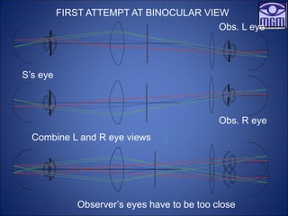 FIRST ATTEMPT AT BINOCULAR VIEW
Obs. L eye
Obs. R eye
S’s eye
Combine L and R eye views
Observer’s eyes have to be too close
 
