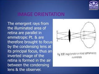 IMAGE ORIENTATION
The emergent rays from
the illuminated area of
retina are parallel in
emmetropic Pt. & are
therefore brought to focus
by the condensing lens at
its principal focus, thus an
inverted image of the
retina is formed in the air
between the condensing
lens & the observer.
 